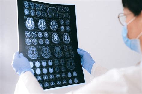 top 10 neurologist in singapore|9 Best Neurologists In Singapore – Our Favourite List.